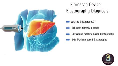 liver elastography vs fibroscan